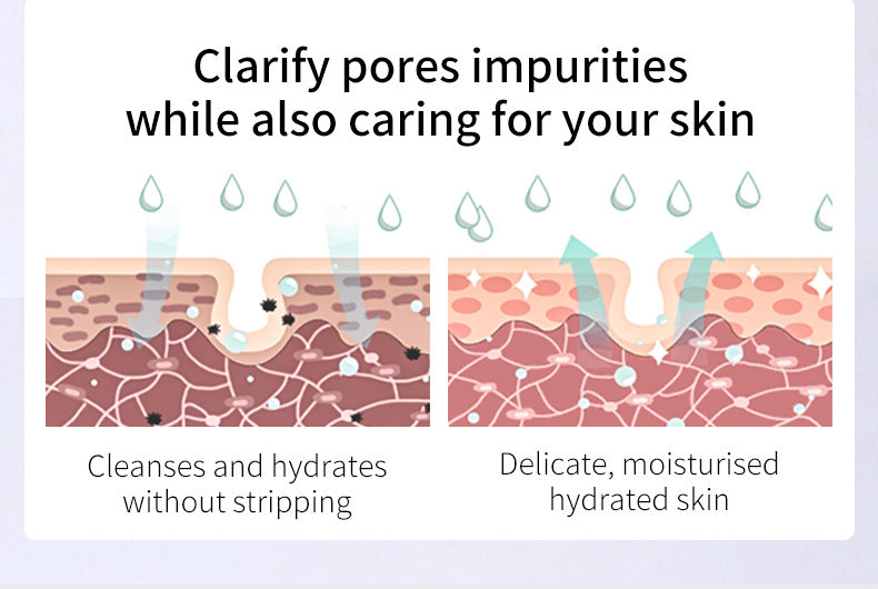 Salicylic Acid Acne Cleanser