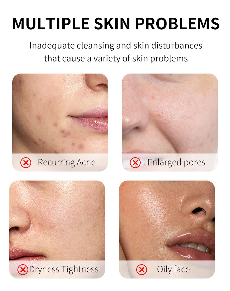 Salicylic Acid Acne Cleanser