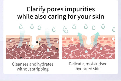 Salicylic Acid Acne Cleanser