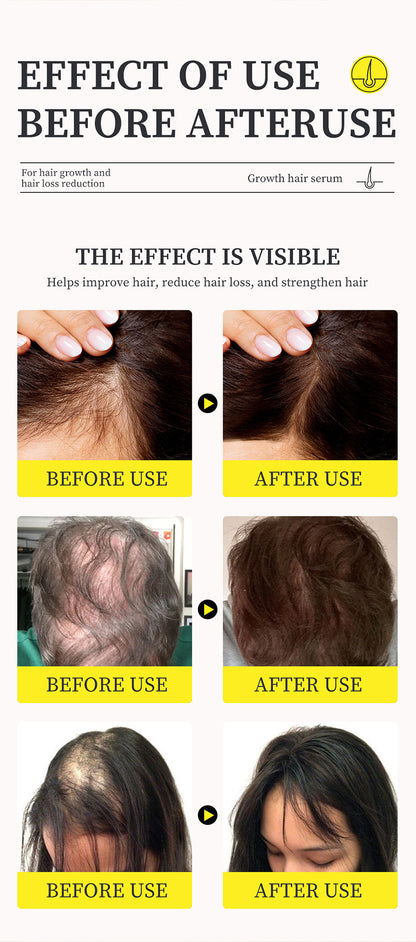 hair-growth-essence-fluid